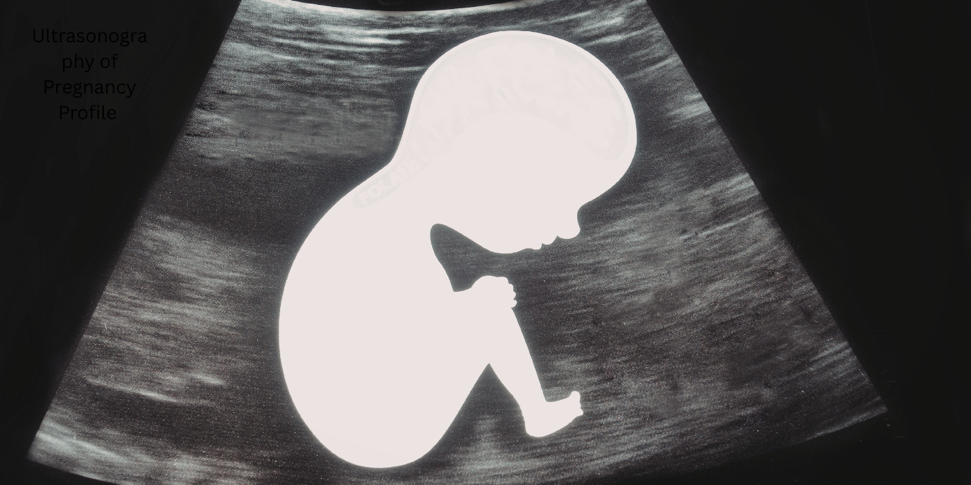 USG of P/P বা Ultrasonography of Pregnancy Profile