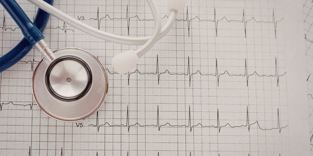 Latest ECG Test Price in Bangladesh